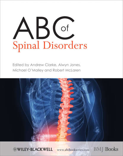 Скачать книгу ABC of Spinal Disorders
