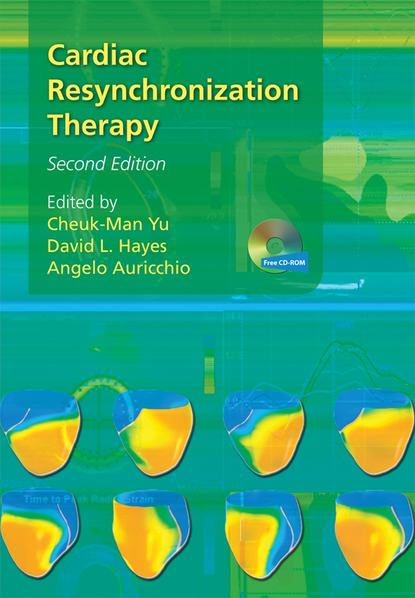 Скачать книгу Cardiac Resynchronization Therapy