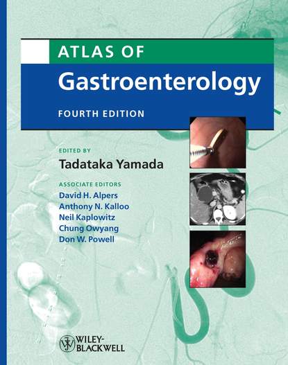 Скачать книгу Atlas of Gastroenterology