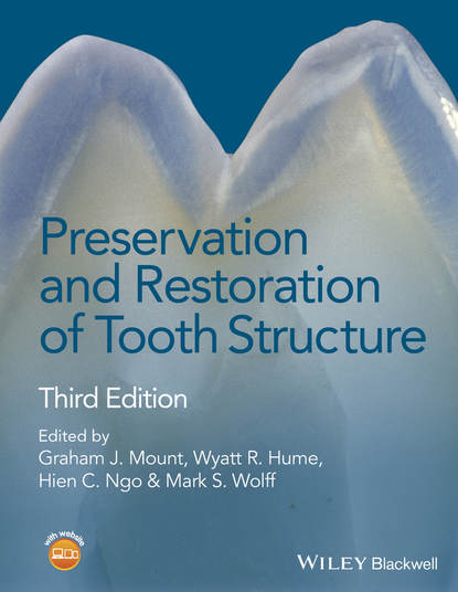 Скачать книгу Preservation and Restoration of Tooth Structure
