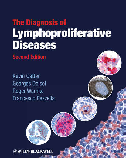 Скачать книгу The Diagnosis of Lymphoproliferative Diseases