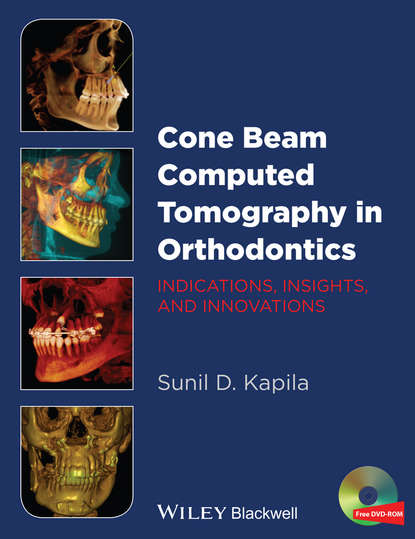 Скачать книгу Cone Beam Computed Tomography in Orthodontics. Indications, Insights, and Innovations