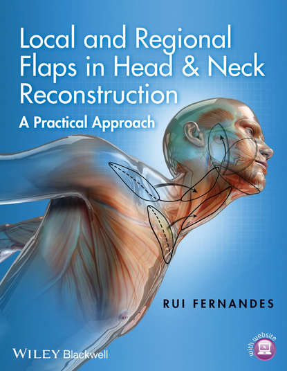 Скачать книгу Local and Regional Flaps in Head and Neck Reconstruction. A Practical Approach