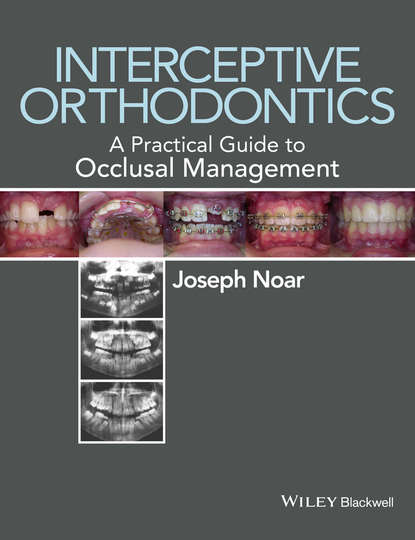 Скачать книгу Interceptive Orthodontics. A Practical Guide to Occlusal Management