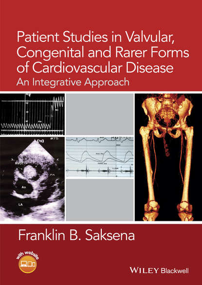 Скачать книгу Patient Studies in Valvular, Congenital and Rarer Forms of Cardiovascular Disease. An Integrative Approach