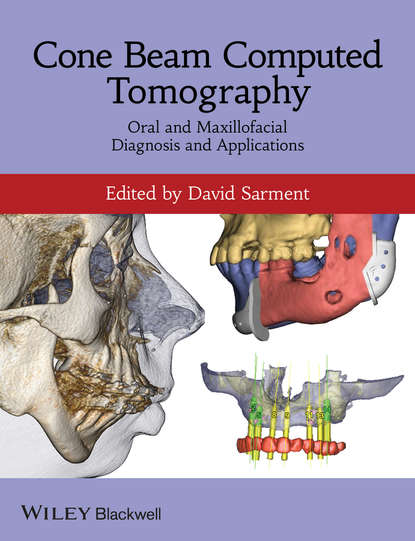 Скачать книгу Cone Beam Computed Tomography. Oral and Maxillofacial Diagnosis and Applications