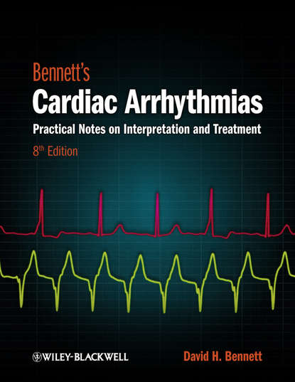 Скачать книгу Bennett's Cardiac Arrhythmias. Practical Notes on Interpretation and Treatment