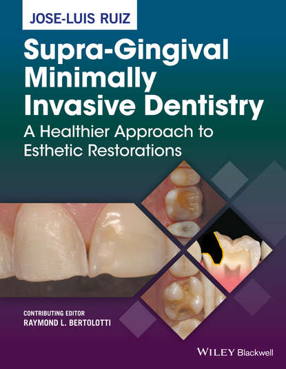 Скачать книгу Supra-Gingival Minimally Invasive Dentistry. A Healthier Approach to Esthetic Restorations