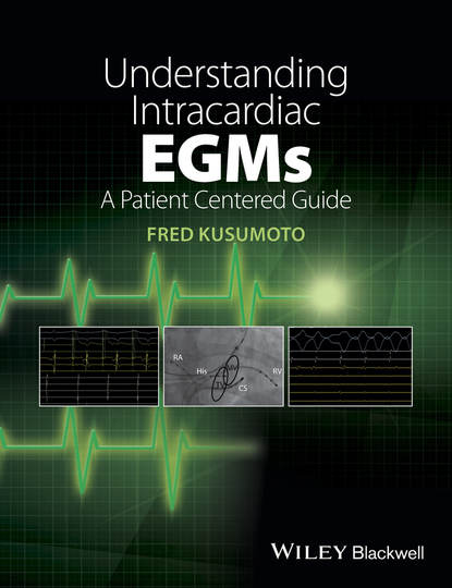 Скачать книгу Understanding Intracardiac EGMs. A Patient Centered Guide