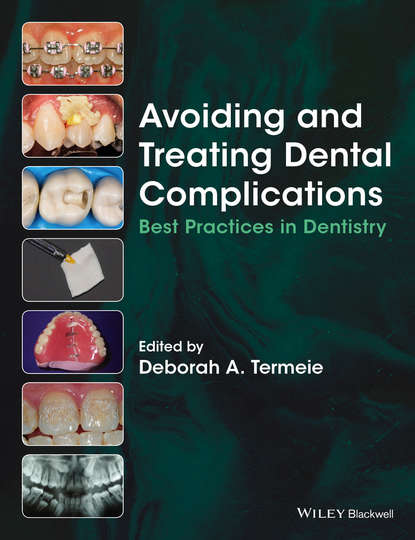 Скачать книгу Avoiding and Treating Dental Complications. Best Practices in Dentistry