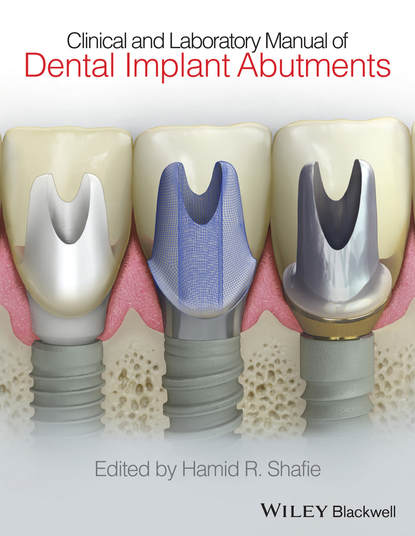 Скачать книгу Clinical and Laboratory Manual of Dental Implant Abutments