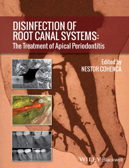 Скачать книгу Disinfection of Root Canal Systems. The Treatment of Apical Periodontitis