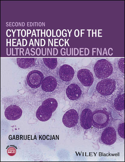 Скачать книгу Cytopathology of the Head and Neck. Ultrasound Guided FNAC