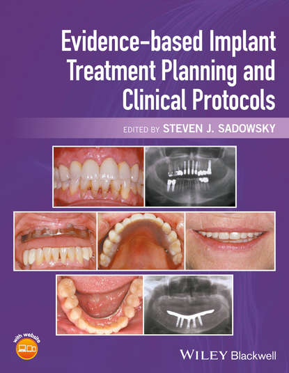 Скачать книгу Evidence-based Implant Treatment Planning and Clinical Protocols