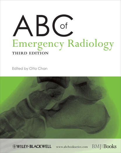 Скачать книгу ABC of Emergency Radiology