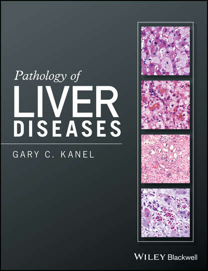 Скачать книгу Pathology of Liver Diseases