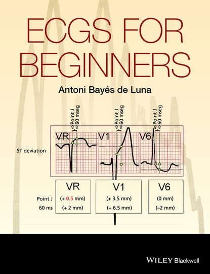 Скачать книгу ECGs for Beginners