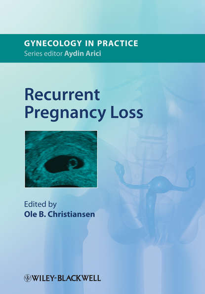 Скачать книгу Recurrent Pregnancy Loss