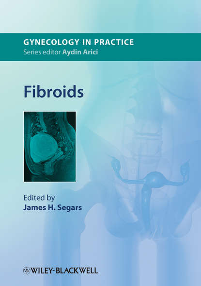 Скачать книгу Fibroids