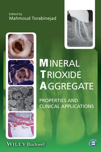 Скачать книгу Mineral Trioxide Aggregate. Properties and Clinical Applications