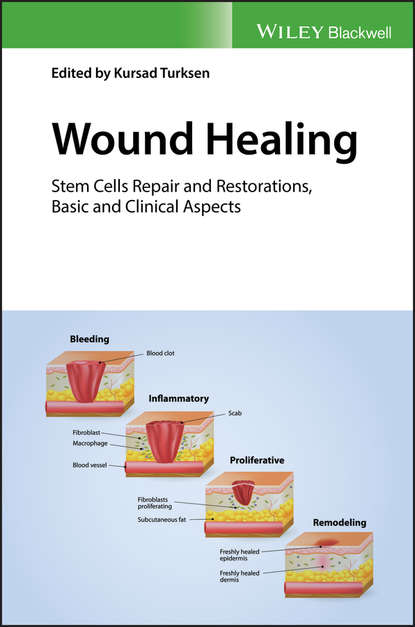 Скачать книгу Wound Healing. Stem Cells Repair and Restorations, Basic and Clinical Aspects