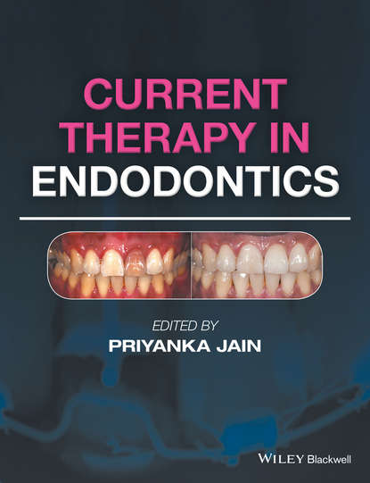 Скачать книгу Current Therapy in Endodontics