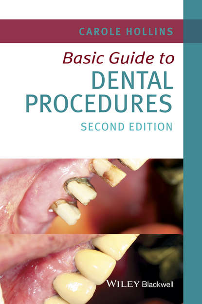 Скачать книгу Basic Guide to Dental Procedures