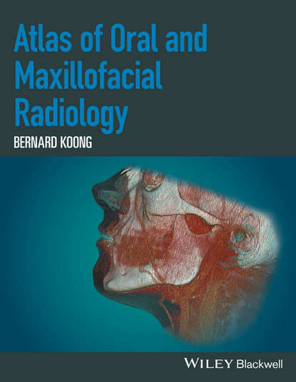 Скачать книгу Atlas of Oral and Maxillofacial Radiology