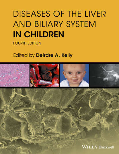 Скачать книгу Diseases of the Liver and Biliary System in Children