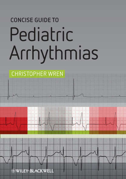Скачать книгу Concise Guide to Pediatric Arrhythmias