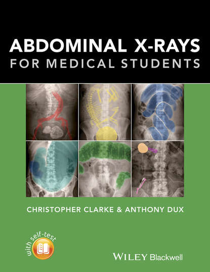 Скачать книгу Abdominal X-rays for Medical Students