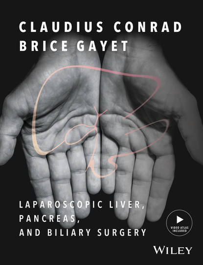 Скачать книгу Laparoscopic Liver, Pancreas, and Biliary Surgery. Textbook and Illustrated Video Atlas