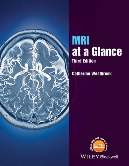 Скачать книгу MRI at a Glance