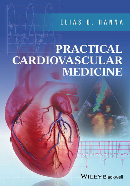 Скачать книгу Practical Cardiovascular Medicine