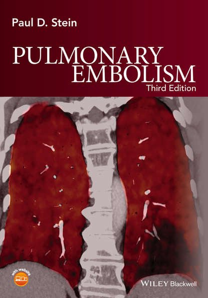 Скачать книгу Pulmonary Embolism
