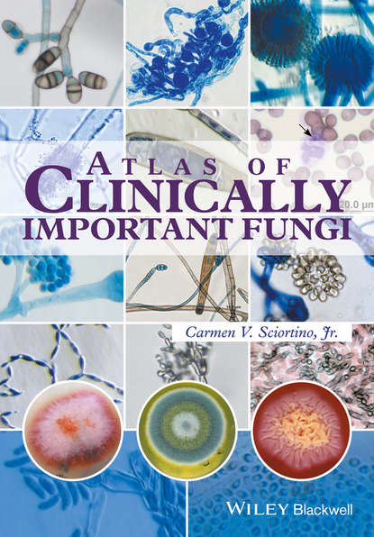 Скачать книгу Atlas of Clinically Important Fungi