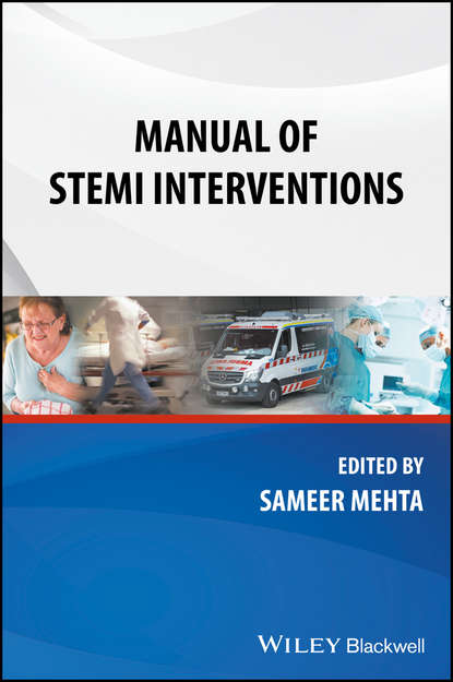 Скачать книгу Manual of STEMI Interventions