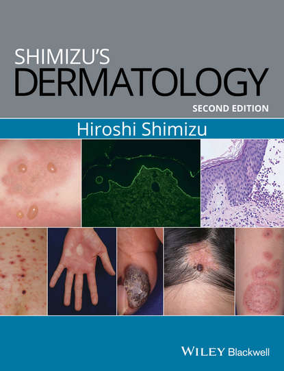 Скачать книгу Shimizu's Dermatology