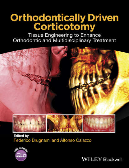 Скачать книгу Orthodontically Driven Corticotomy. Tissue Engineering to Enhance Orthodontic and Multidisciplinary Treatment