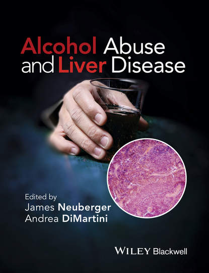 Скачать книгу Alcohol Abuse and Liver Disease