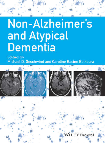Скачать книгу Non-Alzheimer's and Atypical Dementia
