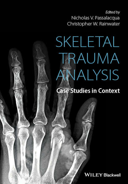 Скачать книгу Skeletal Trauma Analysis. Case Studies in Context