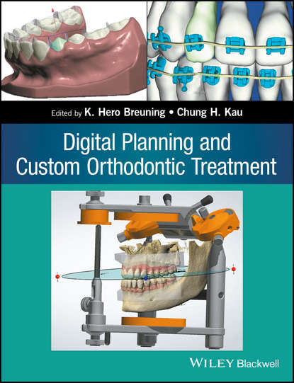 Скачать книгу Digital Planning and Custom Orthodontic Treatment