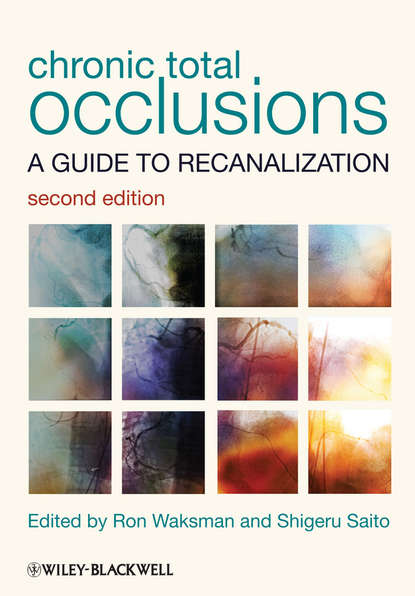 Скачать книгу Chronic Total Occlusions. A Guide to Recanalization