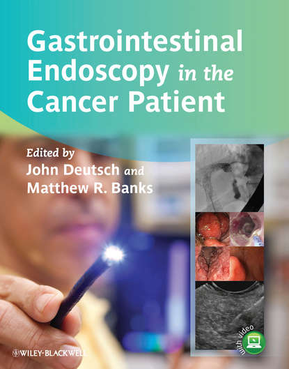 Скачать книгу Gastrointestinal Endoscopy in the Cancer Patient