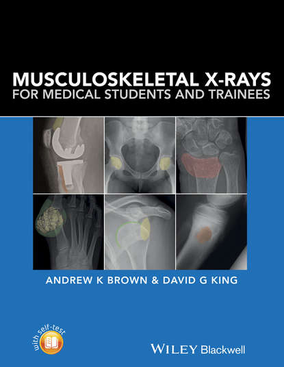 Скачать книгу Musculoskeletal X-Rays for Medical Students and Trainees