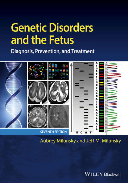 Скачать книгу Genetic Disorders and the Fetus. Diagnosis, Prevention, and Treatment