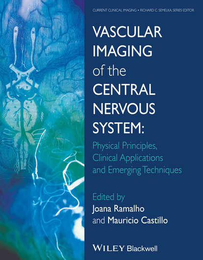 Скачать книгу Vascular Imaging of the Central Nervous System. Physical Principles, Clinical Applications, and Emerging Techniques