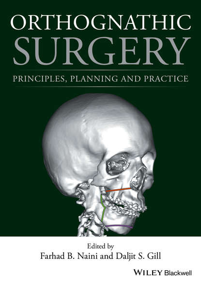 Скачать книгу Orthognathic Surgery. Principles, Planning and Practice