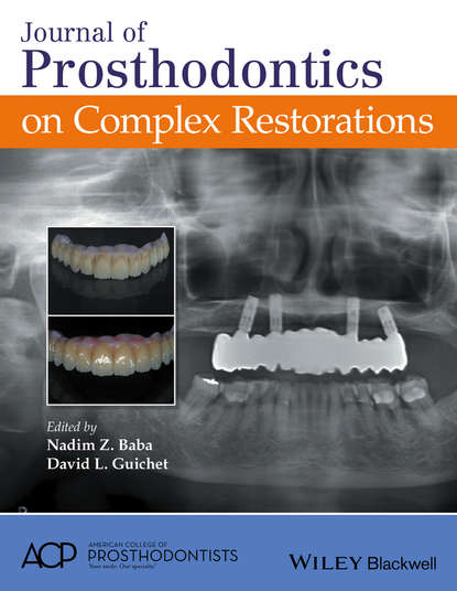 Скачать книгу Journal of Prosthodontics on Complex Restorations